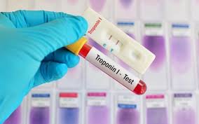 False positive and false negative measurements with Troponin